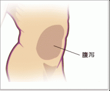 腹泻示意图