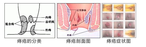 福州肛肠医院