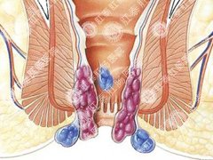 福州肛肠医院
